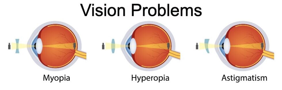 Eye Problems While Driving