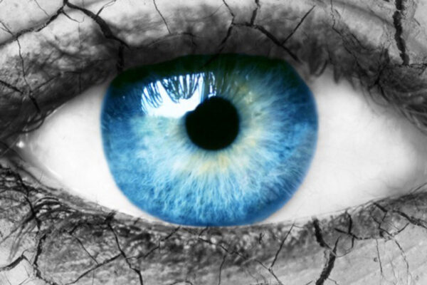 Tips For treating Dry Eyes Tips For treating Dry Eyes